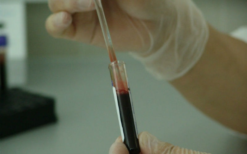 HCM análisis de sangre