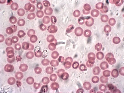 Hemoglobina corpuscular