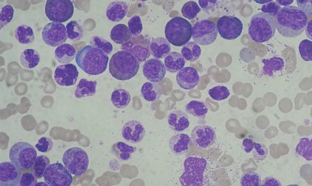 Leucemia mieloide