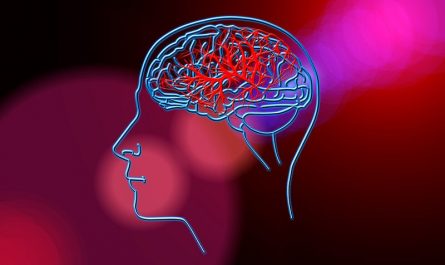 ¿Se puede prevenir una isquemia cerebral?