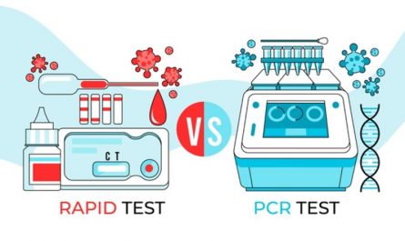 Diferencias entre PCR y test rápidos