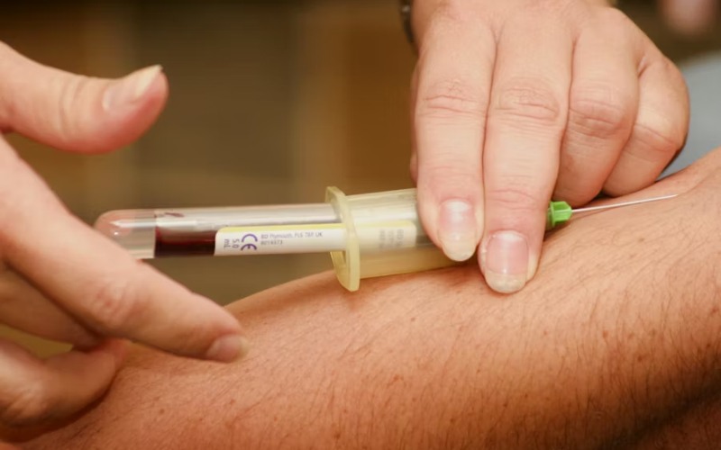 Qué comer antes de una analítica de sangre según la prueba: glucosa, colesterol, hierro y más