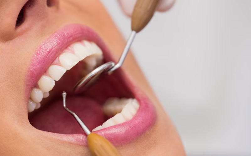 Implantes dentales y las últimas innovaciones clínicas